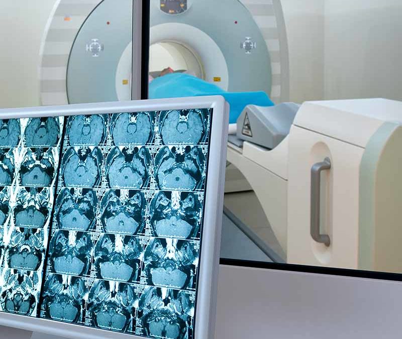 Octreotate Radioligand for Imaging Neuroendocrine Tumors