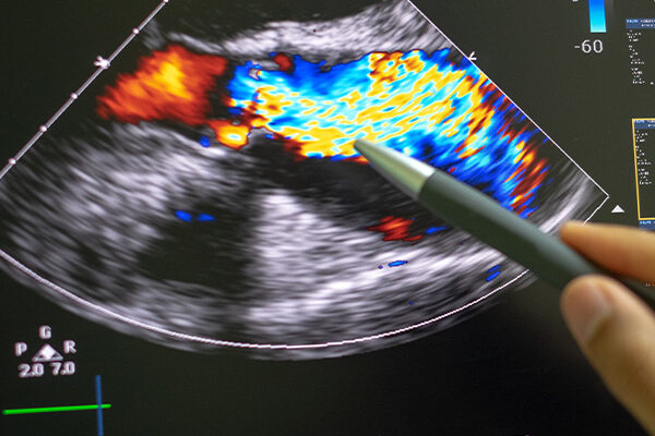 High Quality Quantification of Cardiac Anatomy and Function through 3D deep learning