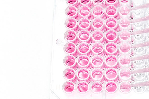 Assay to detect active viral infection