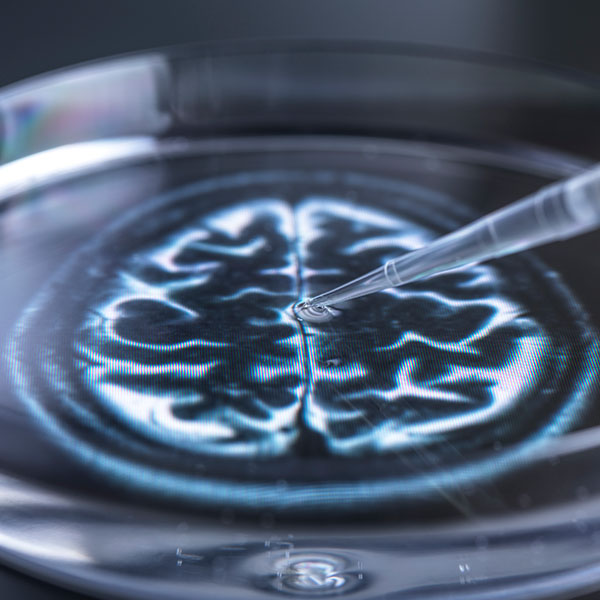 In situ RTQuIC seeding amplification assay for neurodegeneration